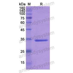 Recombinant Human IRAK2, N-His