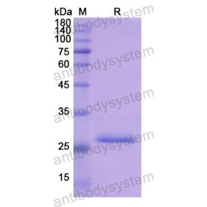 重組KLK10蛋白,Recombinant Human KLK10, N-His