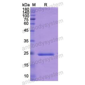 重組ADCY6蛋白,Recombinant Human ADCY6, N-His