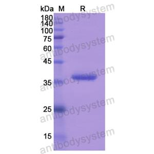 Recombinant Human FGF16, N-SUMO