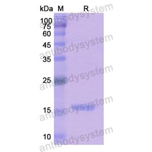 Recombinant Human FIBP, N-His