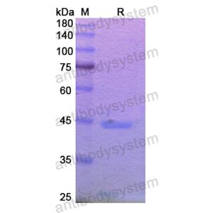 Recombinant Human MGAM/MGA, N-His