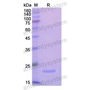 Recombinant Human KLF4, N-His