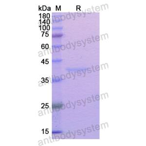 Recombinant Human TGOLN2, N-His