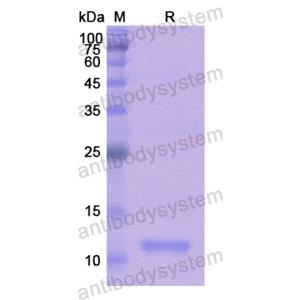 Recombinant Human LAMTOR5, N-His