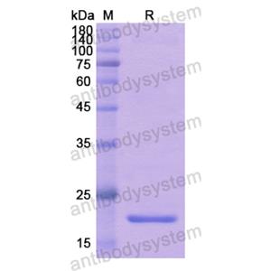 重組WIPF1蛋白,Recombinant Human WIPF1, N-His