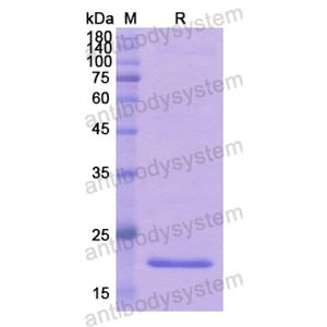 重组CD258/TNFSF14/LIGHT蛋白,Recombinant Human CD258/TNFSF14/LIGHT, N-His