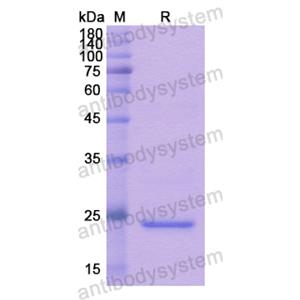 Recombinant Human SPRY2, N-His