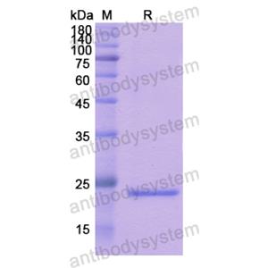 Recombinant Human SPRY3, N-His