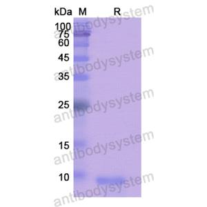 Recombinant Human HCRT, N-His