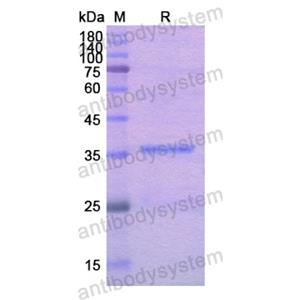 Recombinant Human ACTN4, N-His