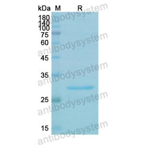 Recombinant Human PRKAB2, N-His