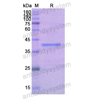 重组NARS1蛋白,Recombinant Human NARS1, N-His