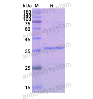 重組CALU蛋白,Recombinant Human CALU, N-His