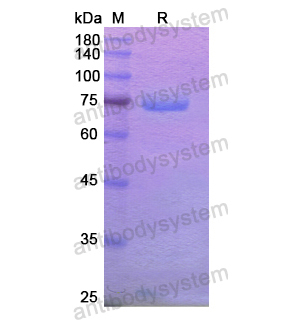 重組XPNPEP2蛋白,Recombinant Human XPNPEP2, N-His