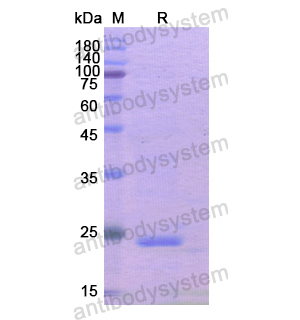 重组GAS2蛋白,Recombinant Human GAS2, N-His