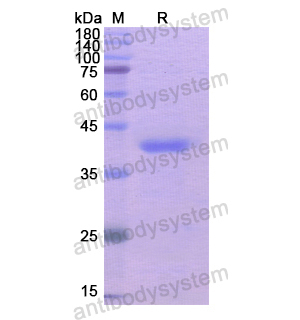 重組AKR1B10蛋白,Recombinant Human AKR1B10, N-His