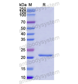 重组FGF17蛋白,Recombinant Human FGF17, N-His