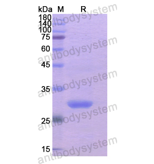 重组PRKN蛋白,Recombinant Human PRKN, N-His