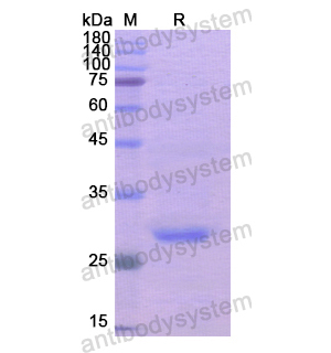 重組ADCY3蛋白,Recombinant Human ADCY3, N-His