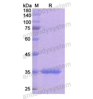 重组CD205/LY75蛋白,Recombinant Human CD205/LY75, N-His