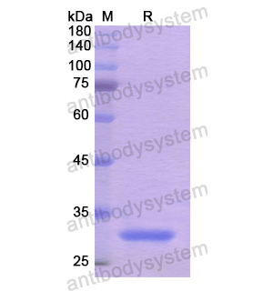 重組NRP2蛋白,Recombinant Human NRP2, N-His