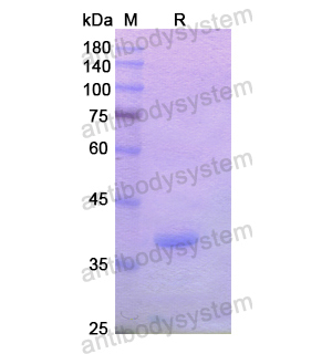 重組CD232/PLXNC1蛋白,Recombinant Human CD232/PLXNC1, N-His