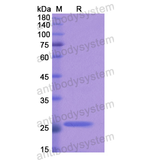 重組ACSL4蛋白,Recombinant Human ACSL4, N-His