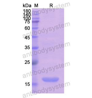 重组EDF1蛋白,Recombinant Human EDF1, N-His