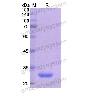 重组SMPD2蛋白,Recombinant Human SMPD2, N-His