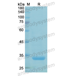 重組CTSV蛋白,Recombinant Human CTSV, N-His