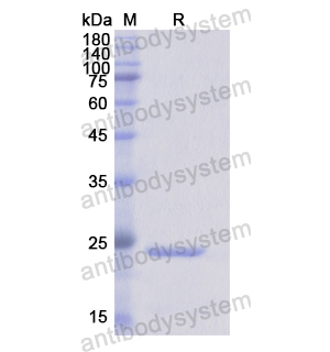 重組CD16b/FCGR3B蛋白,Recombinant Human CD16b/FCGR3B, N-His