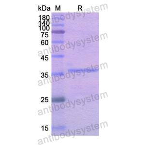 Recombinant Human CALU, N-His