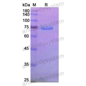 Recombinant Human XPNPEP2, N-His