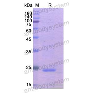 Recombinant Human GAS2, N-His