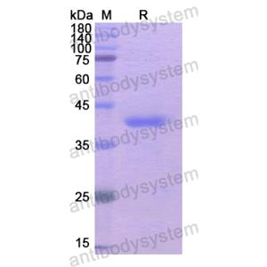 Recombinant Human AKR1B10, N-His