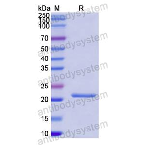 重组FGF17蛋白,Recombinant Human FGF17, N-His