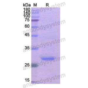 Recombinant Human ADCY3, N-His