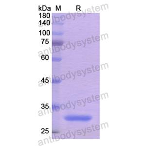 重組NRP2蛋白,Recombinant Human NRP2, N-His