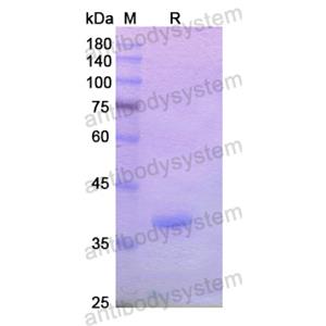 重組CD232/PLXNC1蛋白,Recombinant Human CD232/PLXNC1, N-His