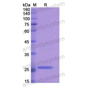 Recombinant Human ACSL4, N-His