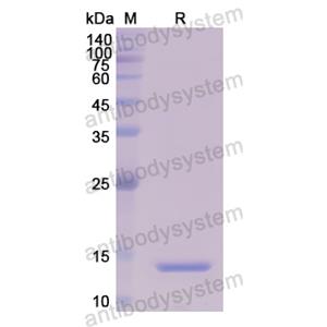 Anti-HRSV F Protein Antibody (131-2A) (RVV02818)