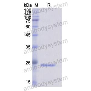 Recombinant Human CD16b/FCGR3B, N-His