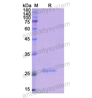 重组NOS1AP蛋白,Recombinant Human NOS1AP, N-His