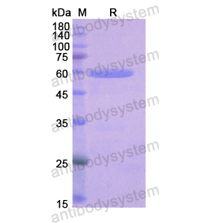 重組LRP4蛋白,Recombinant Human LRP4, N-GST