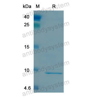 重組LRP5蛋白,Recombinant Human LRP5, N-His