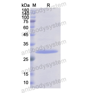 重組CDH16蛋白,Recombinant Human CDH16, N-His