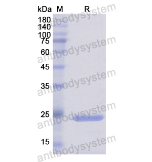 重組DUSP11蛋白,Recombinant Human DUSP11, N-His