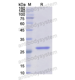 重組ALOX12B蛋白,Recombinant Human ALOX12B, N-His