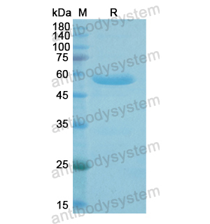 重組MACROH2A1蛋白,Recombinant Human MACROH2A1, N-GST